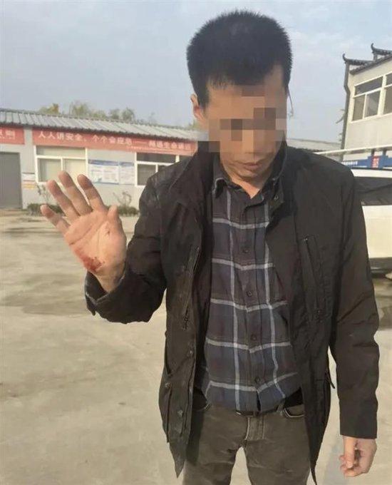 记者在采访过程中遭受袭击，5名相关人员被拘留