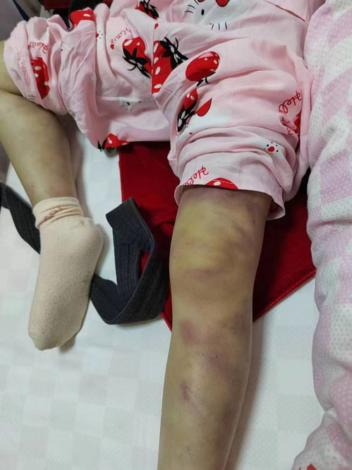 痛心！3岁女童被虐致死：一个母亲的煎熬与期盼