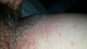 解密：星星腿上的胎记背后的故事