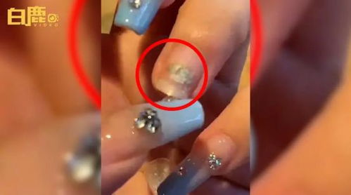 美甲后指甲长霉菌：美丽背后的隐忧