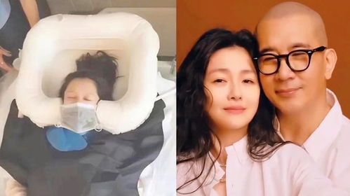 大S与癫痫的抗争：小S泪目回忆姐姐昏迷瞬间