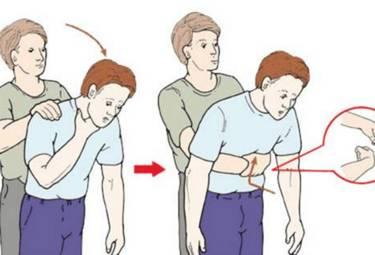 10岁男孩的英勇时刻：海姆立克法救妈妈