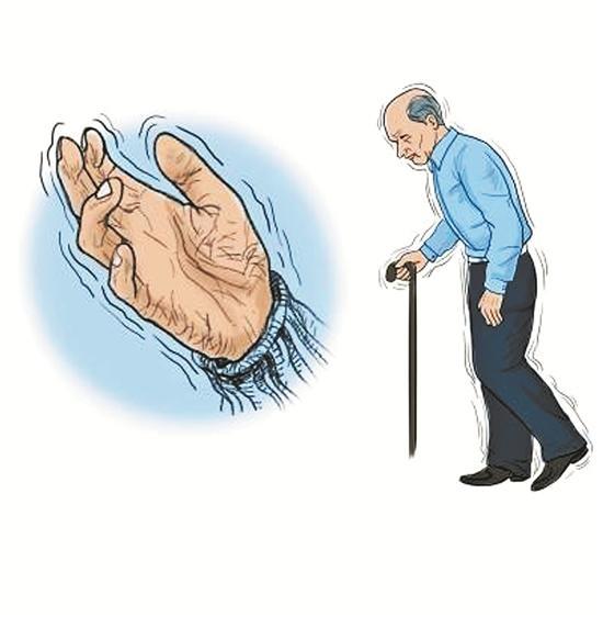 帕金森疾病都是吃出来的？这3种食物竟是对病情恶化的“同伙”，尽量不要碰