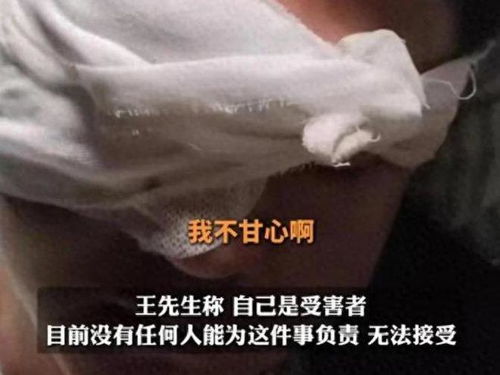 除夕夜噩梦：被烟花击中，他失去了右眼，如今寻找目击者还原真相