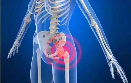 脊髓炎患者的早晨：一份温暖的运动指南