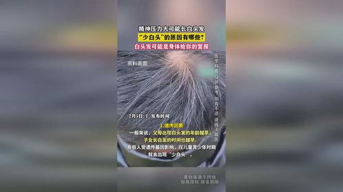 白头发是身体给你的压力警告，如何拯救你的发色？