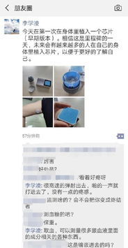 湖北男子植入“戒酒芯片”：科技与健康的碰撞