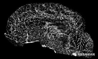 《Nature》新突破：Slide-tags技术引领多模态空间基因组学的未来