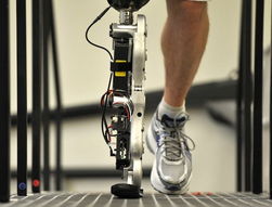 国产智能仿生假肢量产：科技改变生活的奇迹