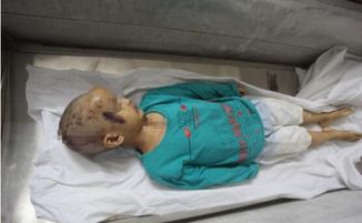 痛心！2岁男童托育园午睡时离世，背后真相令人深思