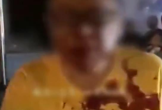 外卖员脚被碾压仍哭求先送完单：背后的辛酸与社会反思