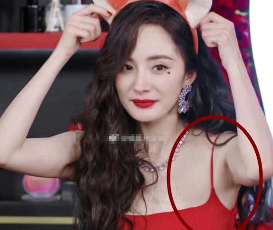 杨幂谈右胳膊钙化：舞台上的坚持与背后的辛酸
