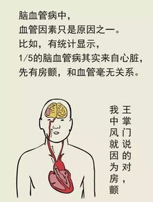 脑卒中常见的10大误区，你中招了吗？