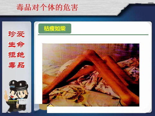 帕金森：一场与命运的持久战斗