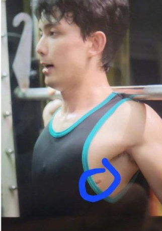 多位明星曾患气胸，他却用亲身经历告诉你健康的重要性