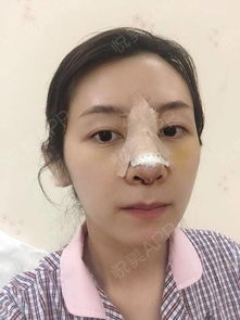 揭秘：打一针究竟能“保鲜”多久？整形医生的专业解读