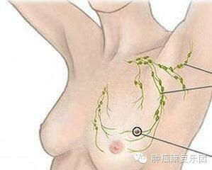 腋窝发黑的真相与护理秘籍，他亲测有效！