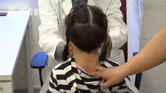 13岁留守女孩脊柱侧弯80度：她的故事让我泪目