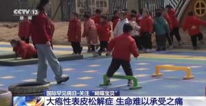 女孩确诊“蝴蝶宝贝”皮肤一碰就碎，她的故事让我泪流满面