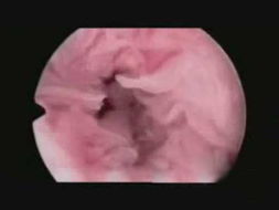 建议适当放开卵巢组织及卵子冻存：从个体生育力保护到社会支持体系的思考