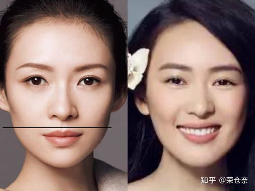 瘦30斤后，面部折叠度变化的惊人真相！