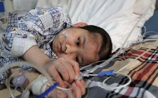 14岁男孩患早期肺癌：爸爸是老烟民，家庭悲剧背后的健康警钟