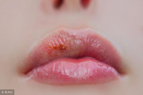 嘴唇干裂？从今天开始养成这些好习惯，让双唇水润一整年！