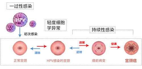 加入女性HPV私聊群：一场关于健康与支持的深度探索