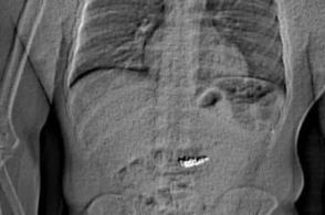 巴黎世家薯片包售价7100元，我该如何看待这一现象？