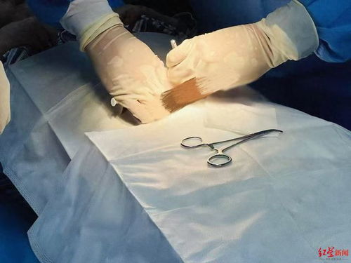 植入“戒酒芯片”：她从每日豪饮1-3斤白酒到完全不想碰酒的秘密