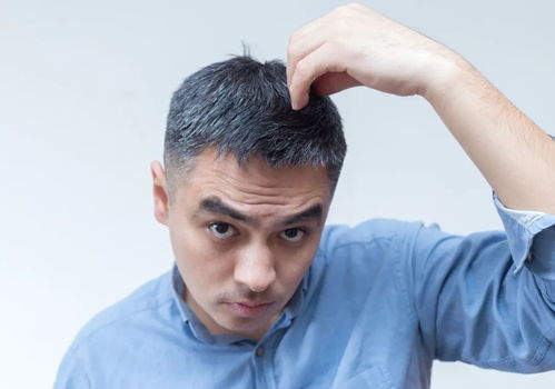 头发白了，还能变黑吗？答案来了