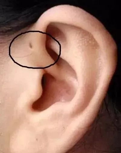 宝宝耳朵大如小弥勒佛，背后的故事温暖人心