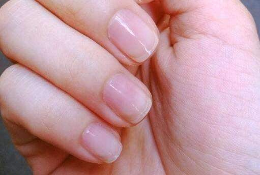 指甲上没月牙是营养不良吗？真相可能让你大吃一惊