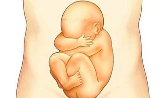 胎儿在妈妈肚子里4根手指被“缠住”：一场惊心动魄的生命守护