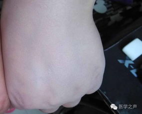 护士抽血找不到血管连续扎针，真相竟是这样！