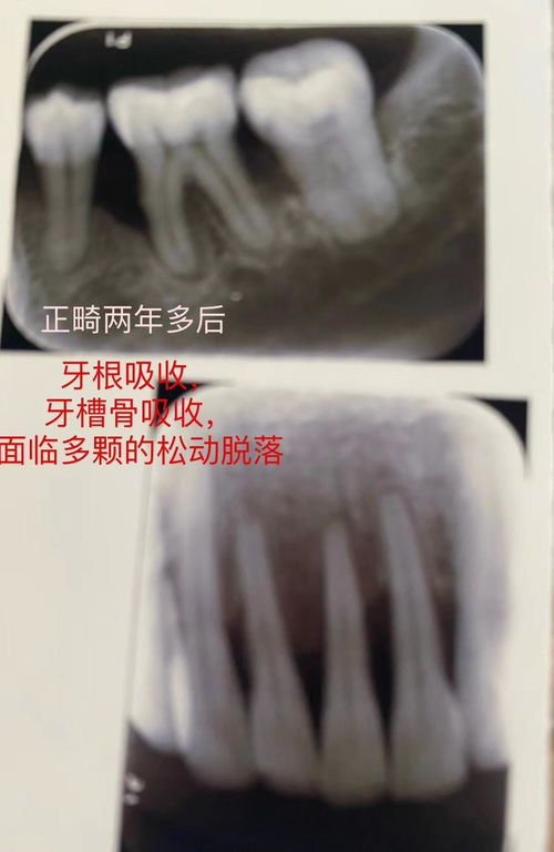 省卫健委介入调查：被拔错牙女子坠亡事件的真相与反思