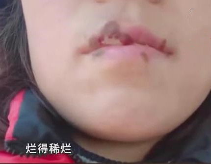 纹唇后老公笑不停，女子的美丽计划竟变成“笑料”？