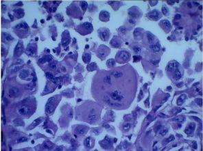 亚致死高温如何影响肿瘤细胞？关键通路与表型解析