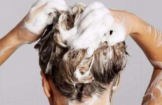 错误洗头方式会导致脂溢性皮炎？我的亲身经历告诉你真相