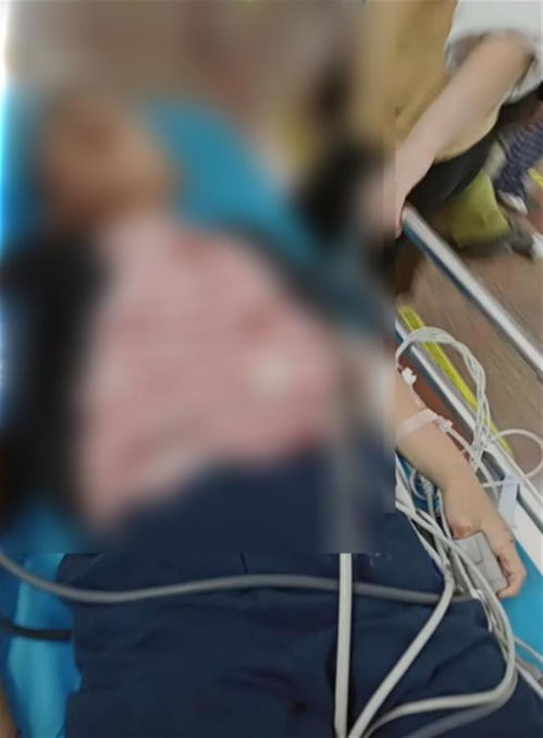 幼儿园事故频发！6岁儿童被筷子插鼻穿孔，责任如何划分？