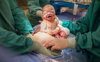 震惊！17岁少女代孕产子背后：被物化的生育工具与法律的沉默