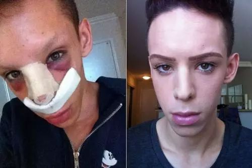 甲亢哥的滤镜奇遇：当真实与美颜碰撞