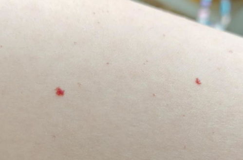 红点点：简书的治愈系功能，专治“强迫症”