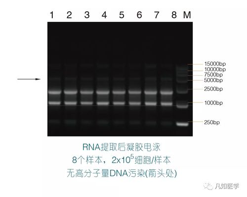 电泳条带灰度定量分析：新手也能轻松搞定的实验技巧