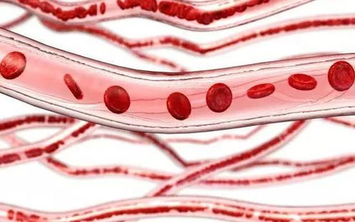 血管里“长石头”？竟是因为这个指标高！