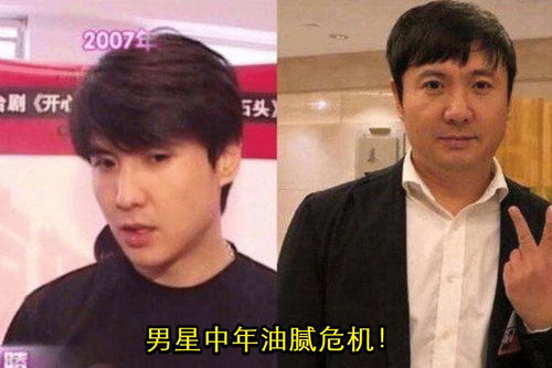 潘玮柏减重20斤后，下颚线杀伤力爆表！