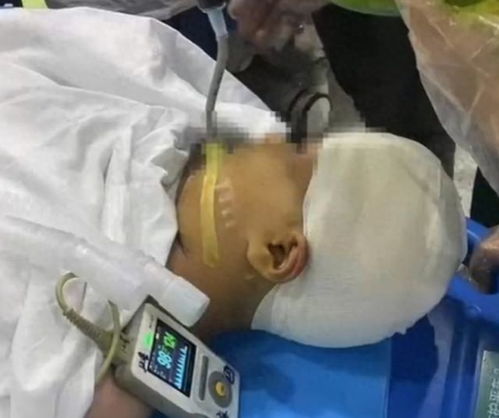 9岁女孩被老师打碎头骨案二审将宣判：真相与正义的较量