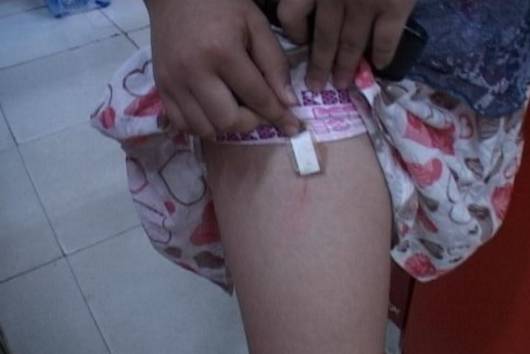 15岁男孩在家做实验被炸伤：血的教训背后的警示