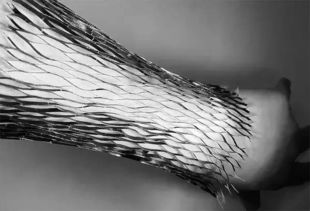 麻省理工研发新型避孕针：一针管数年，科技改变生活