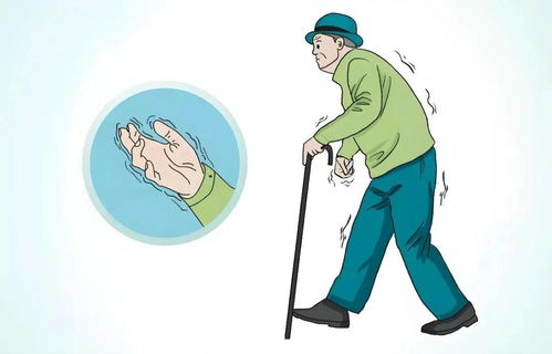 帕金森病患者适合的锻炼方式，让生活更有质量